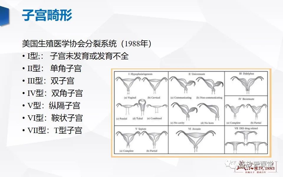 影像PPT - 【PPT】子宫病变MRI诊断-12