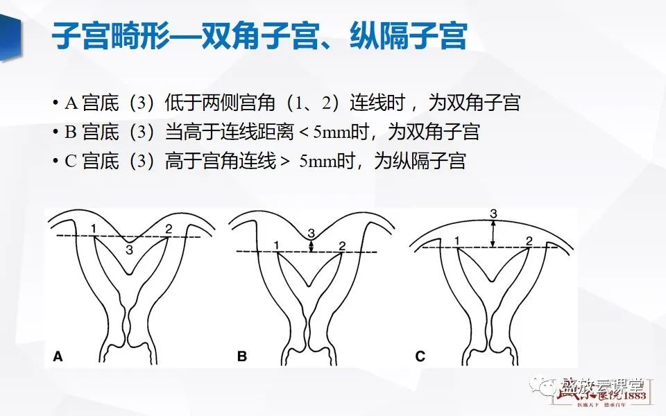 影像PPT - 【PPT】子宫病变MRI诊断-19