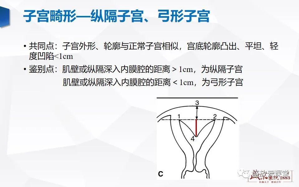 影像PPT - 【PPT】子宫病变MRI诊断-20