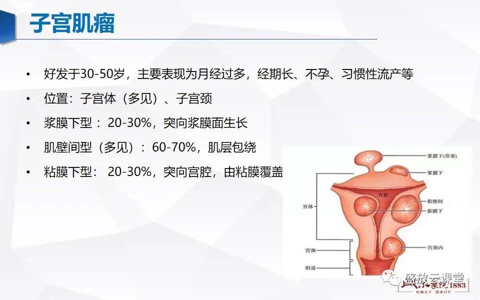 影像PPT - 【PPT】子宫病变MRI诊断-22