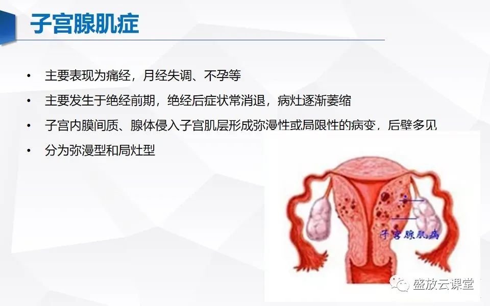 影像PPT - 【PPT】子宫病变MRI诊断-27