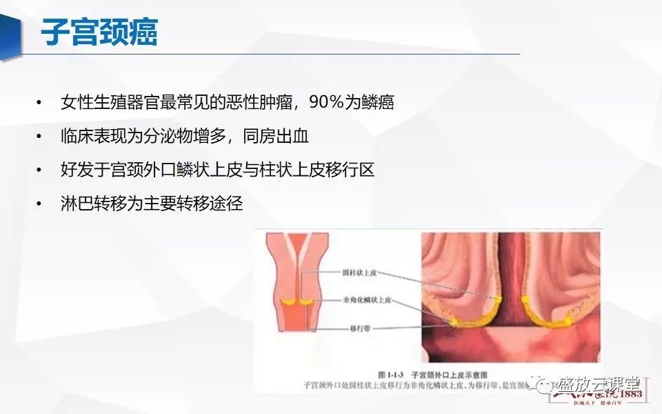 影像PPT - 【PPT】子宫病变MRI诊断-41