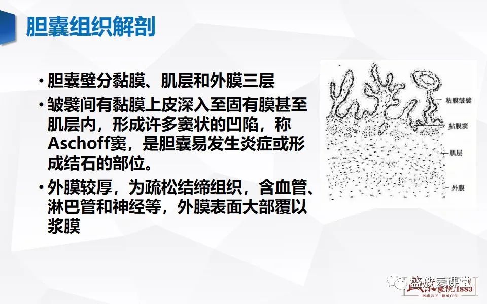 影像PPT - 【PPT】胆囊窝积液的影像学表现及临床意义-4