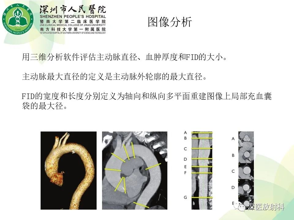 影像PPT - 【PPT】B型主动脉壁内血肿多层螺旋CT局灶性内膜破裂大小与疾病进展的关系-16
