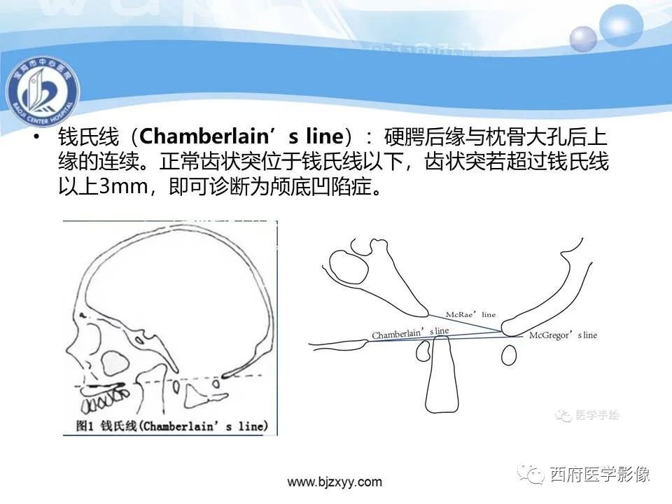 影像PPT - 【PPT】颅底凹陷症的影像诊断-10