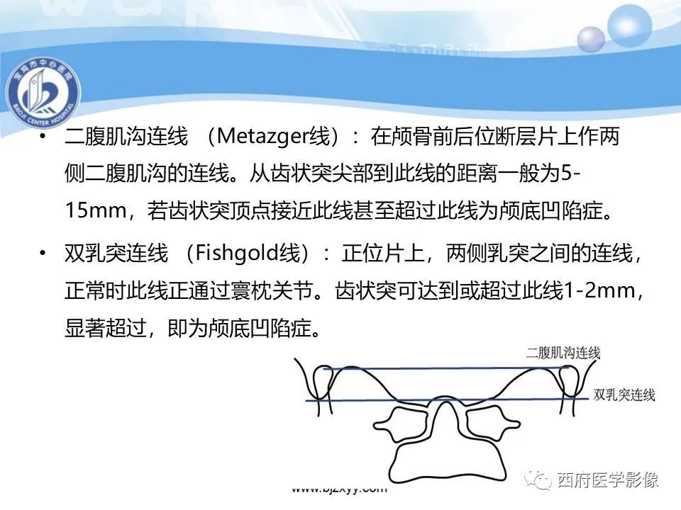 影像PPT - 【PPT】颅底凹陷症的影像诊断-14