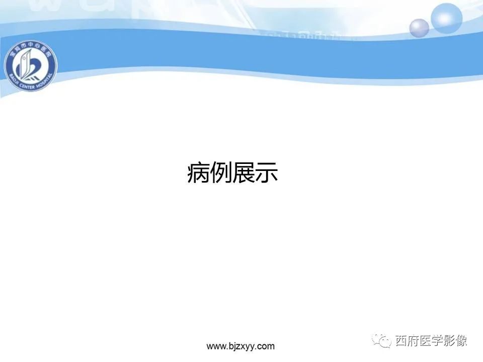 影像PPT - 【PPT】颅底凹陷症的影像诊断-33