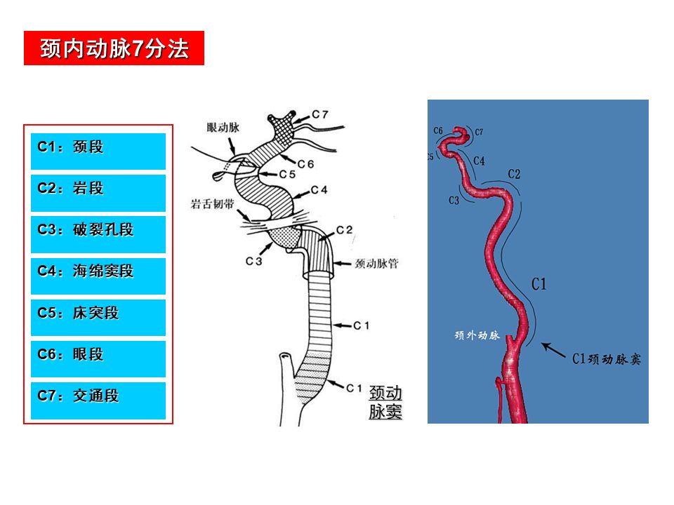 影像PPT - 【PPT】脑动脉分段解析-5