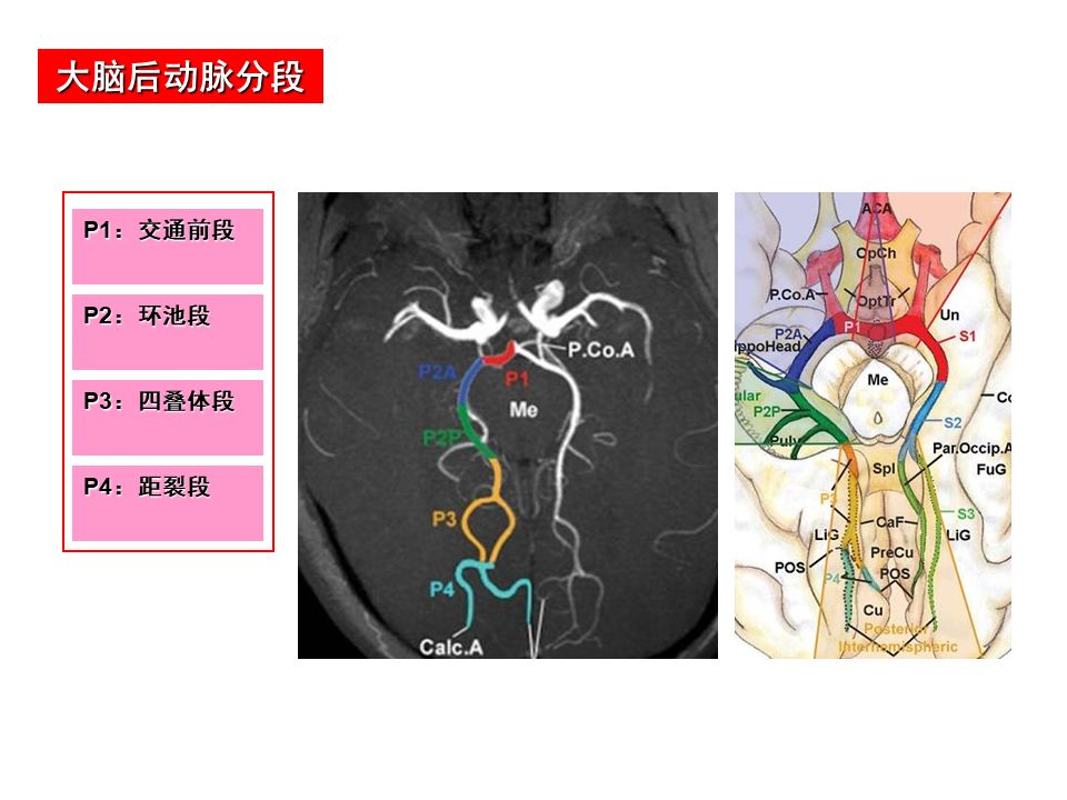 影像PPT - 【PPT】脑动脉分段解析-13