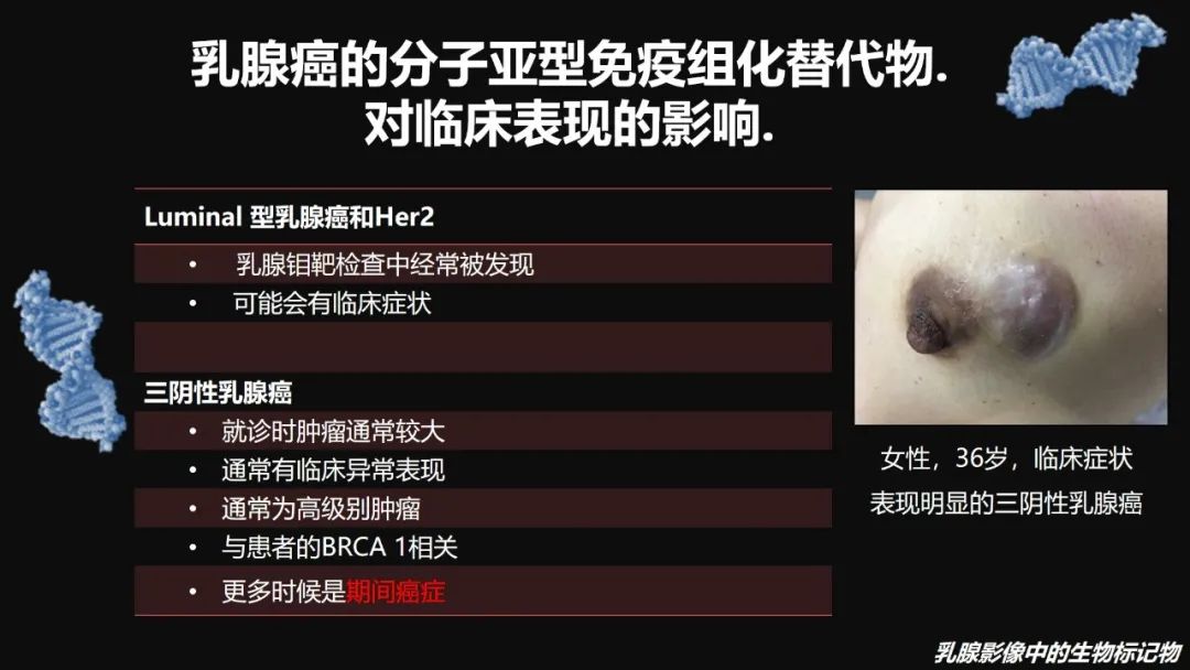 影像PPT - 【PPT】​乳腺影像中的生物标记物-46