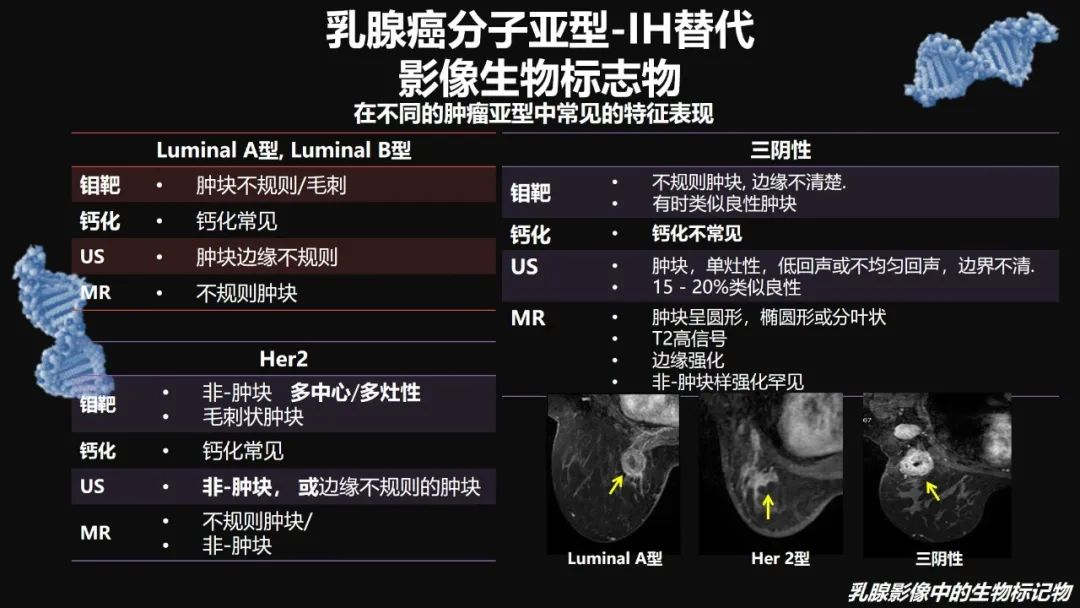 影像PPT - 【PPT】​乳腺影像中的生物标记物-50