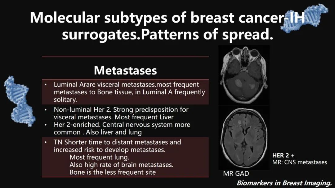 影像PPT - 【PPT】​乳腺影像中的生物标记物-57