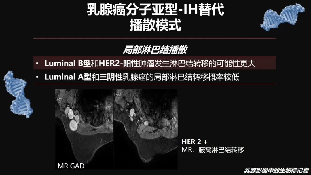影像PPT - 【PPT】​乳腺影像中的生物标记物-56