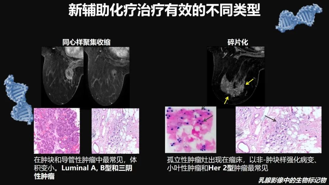 影像PPT - 【PPT】​乳腺影像中的生物标记物-62