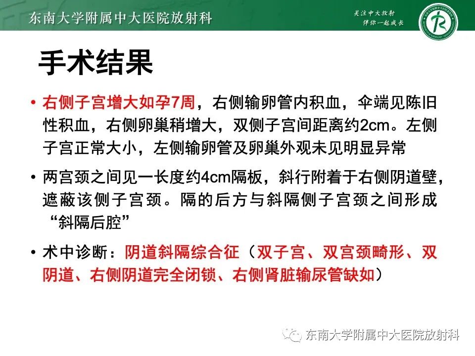 影像PPT - 【PPT】阴道斜隔综合征-3