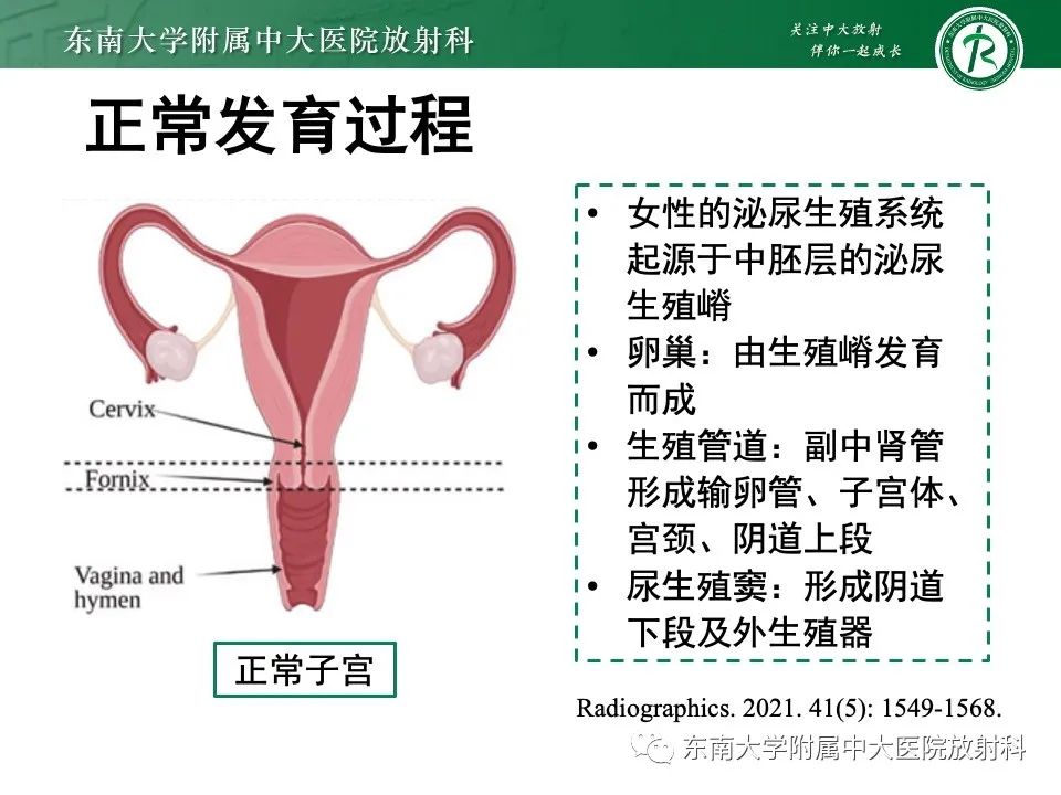 影像PPT - 【PPT】阴道斜隔综合征-8