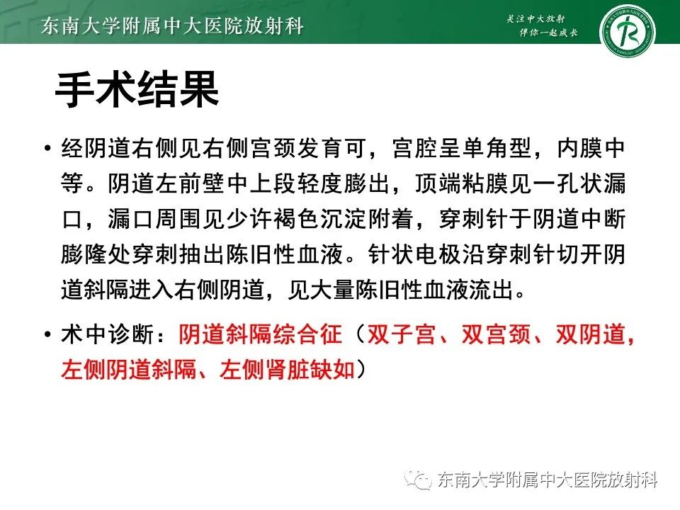 影像PPT - 【PPT】阴道斜隔综合征-15