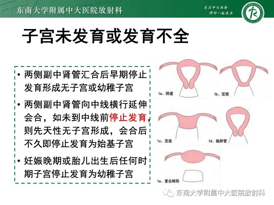 影像PPT - 【PPT】阴道斜隔综合征-18