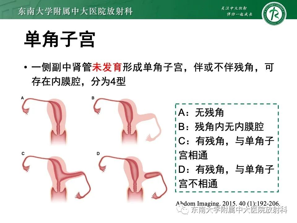 影像PPT - 【PPT】阴道斜隔综合征-20