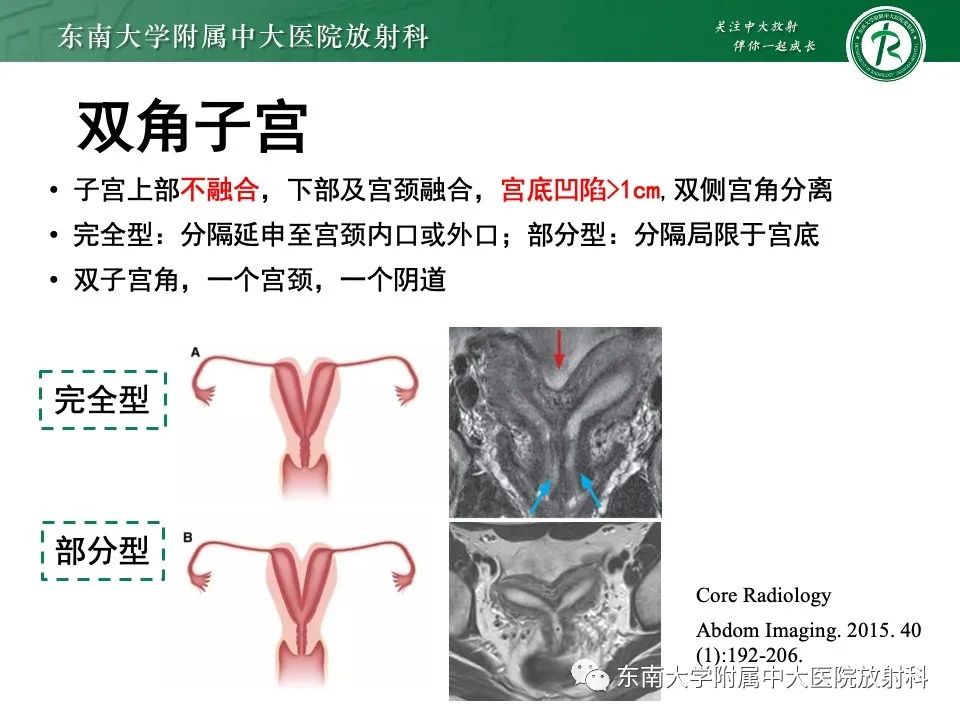 影像PPT - 【PPT】阴道斜隔综合征-22