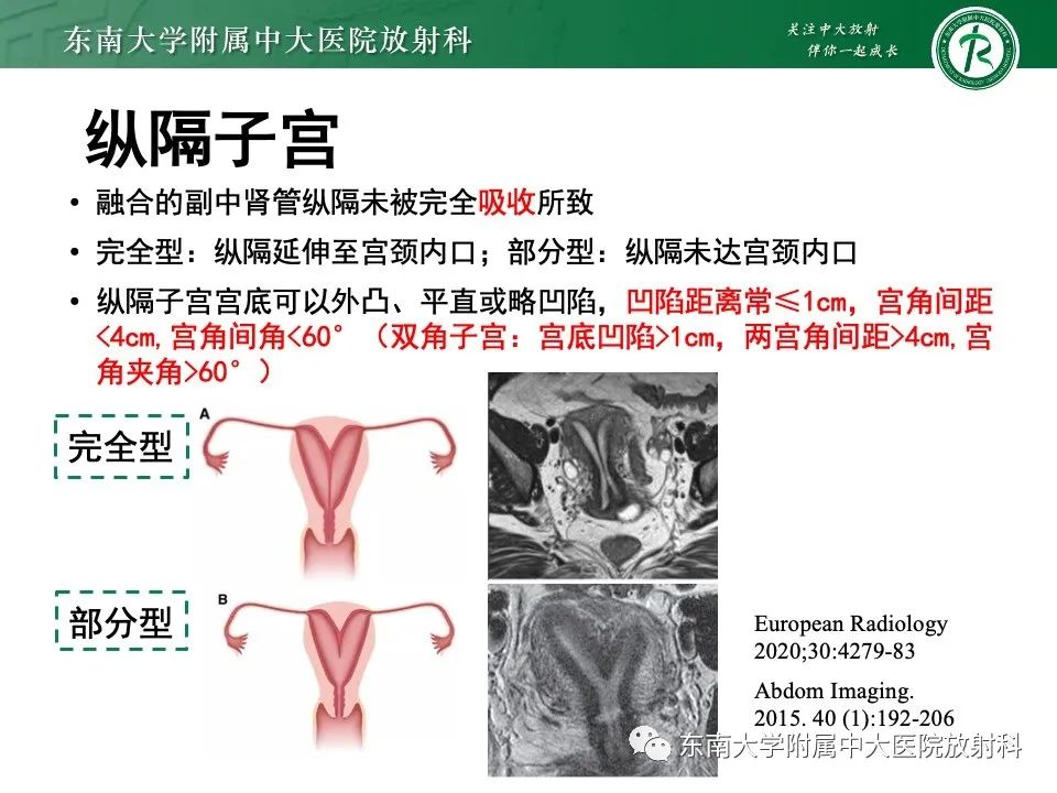影像PPT - 【PPT】阴道斜隔综合征-23