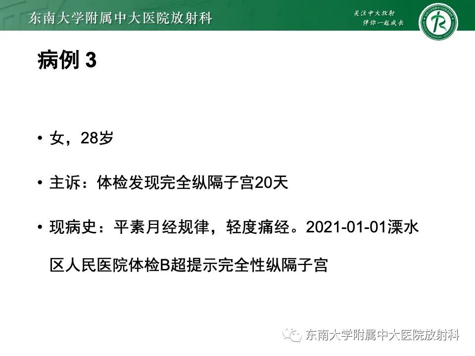 影像PPT - 【PPT】阴道斜隔综合征-24