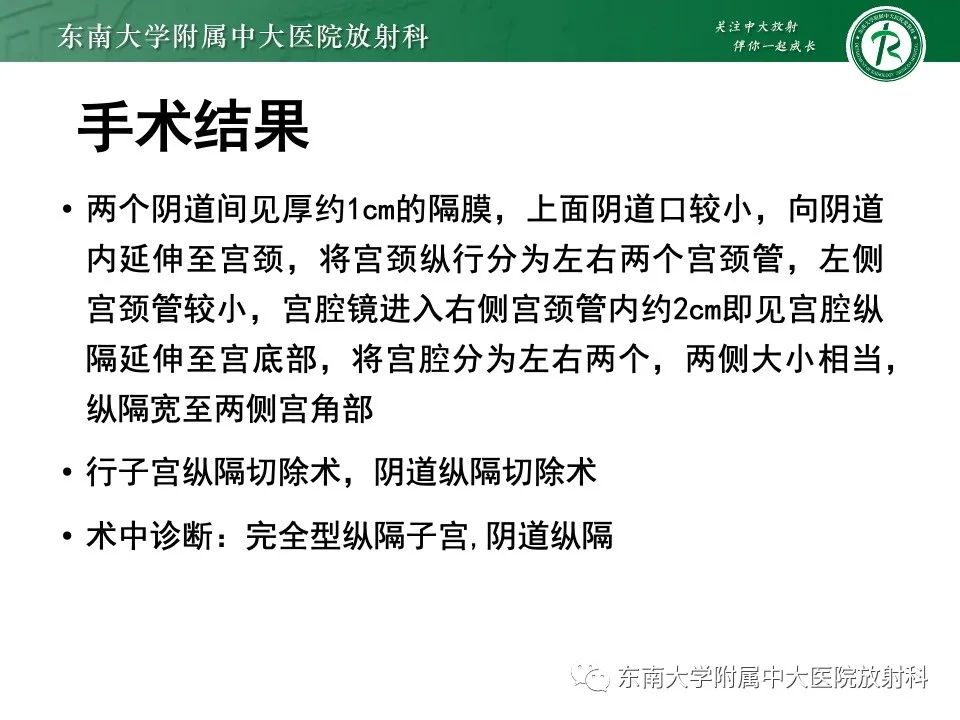 影像PPT - 【PPT】阴道斜隔综合征-26