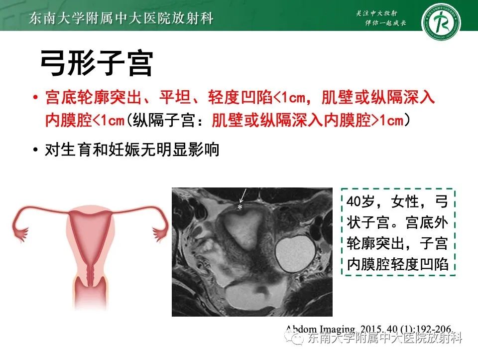 影像PPT - 【PPT】阴道斜隔综合征-27
