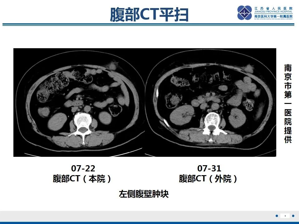 影像PPT - 【PPT】脊髓内脓肿-7