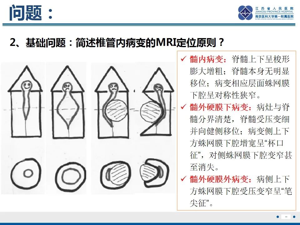 影像PPT - 【PPT】脊髓内脓肿-12
