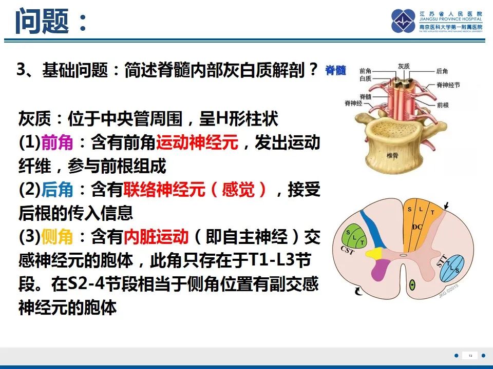 影像PPT - 【PPT】脊髓内脓肿-14