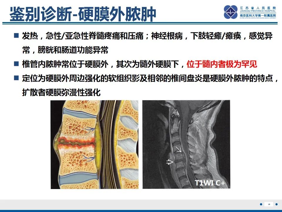 影像PPT - 【PPT】脊髓内脓肿-36