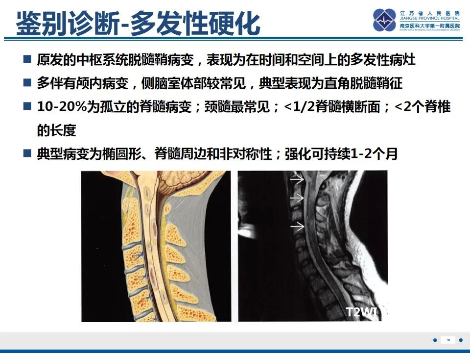 影像PPT - 【PPT】脊髓内脓肿-37
