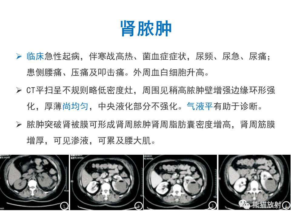 影像PPT - 【PPT】肾脏神经内分泌肿瘤 VS 肾透明细胞癌-51