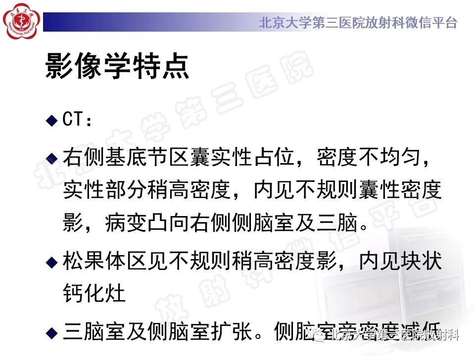 影像PPT - 【PPT】颅内生殖细胞瘤-9