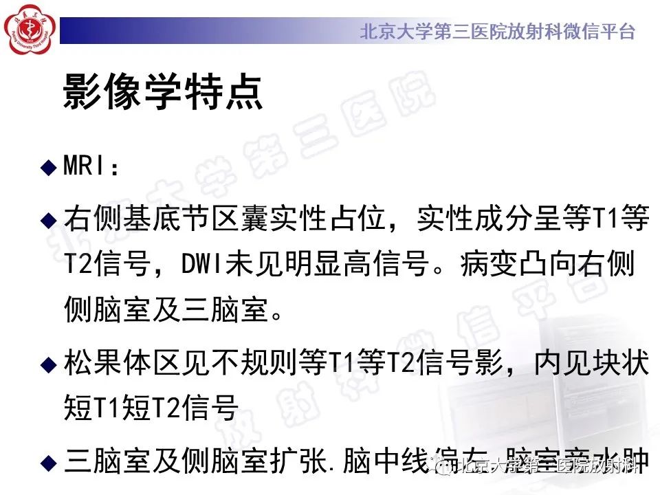 影像PPT - 【PPT】颅内生殖细胞瘤-10