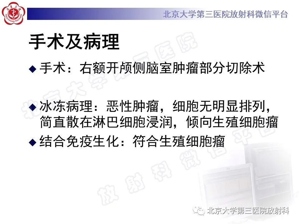 影像PPT - 【PPT】颅内生殖细胞瘤-11