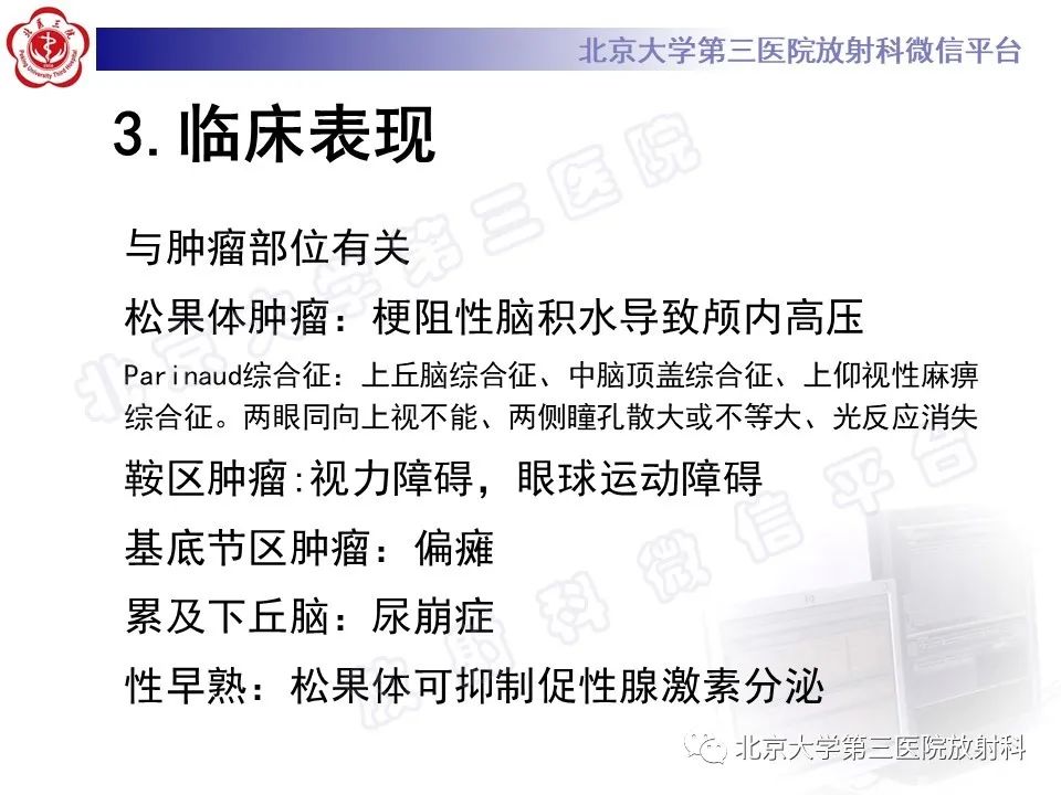影像PPT - 【PPT】颅内生殖细胞瘤-16