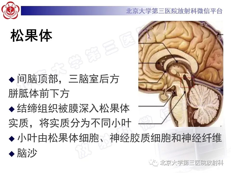 影像PPT - 【PPT】颅内生殖细胞瘤-20