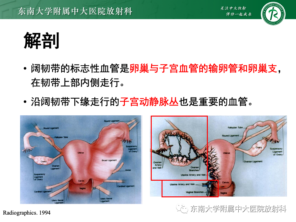 影像PPT - 【PPT】阔韧带疝-8