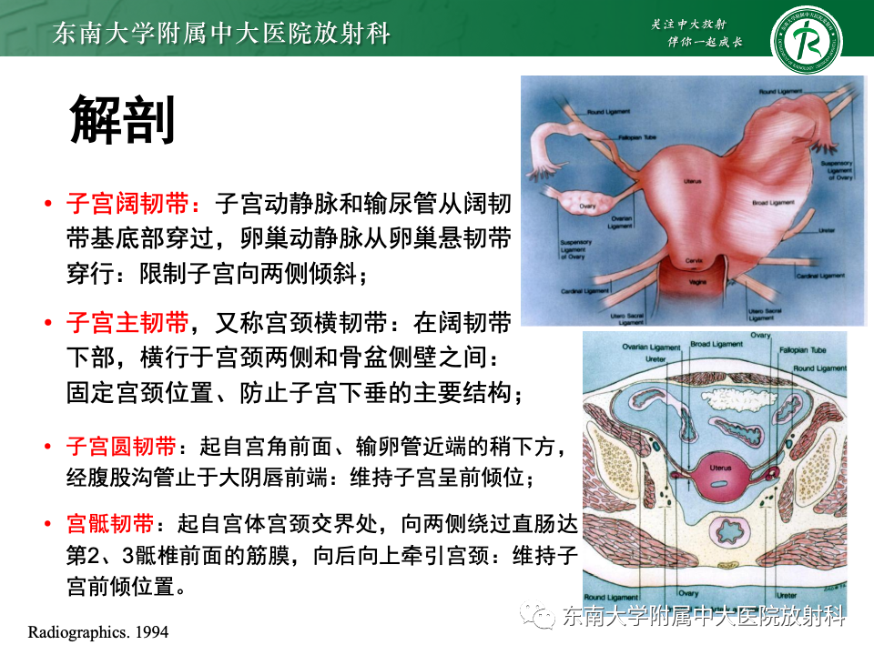 影像PPT - 【PPT】阔韧带疝-9