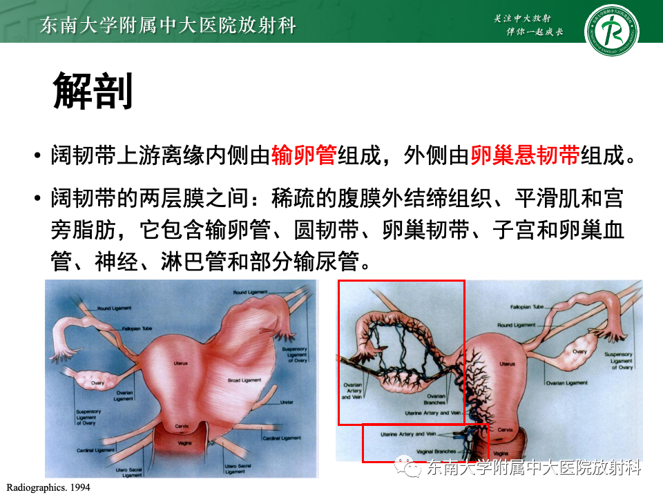 影像PPT - 【PPT】阔韧带疝-7