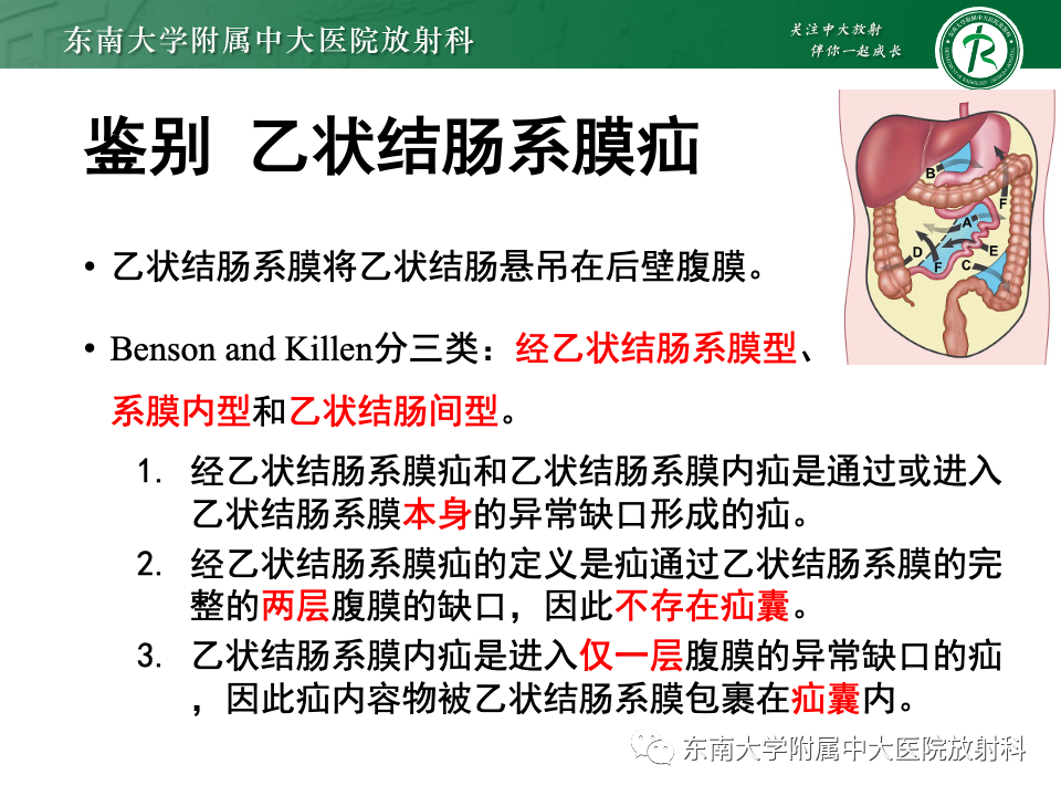 影像PPT - 【PPT】阔韧带疝-21