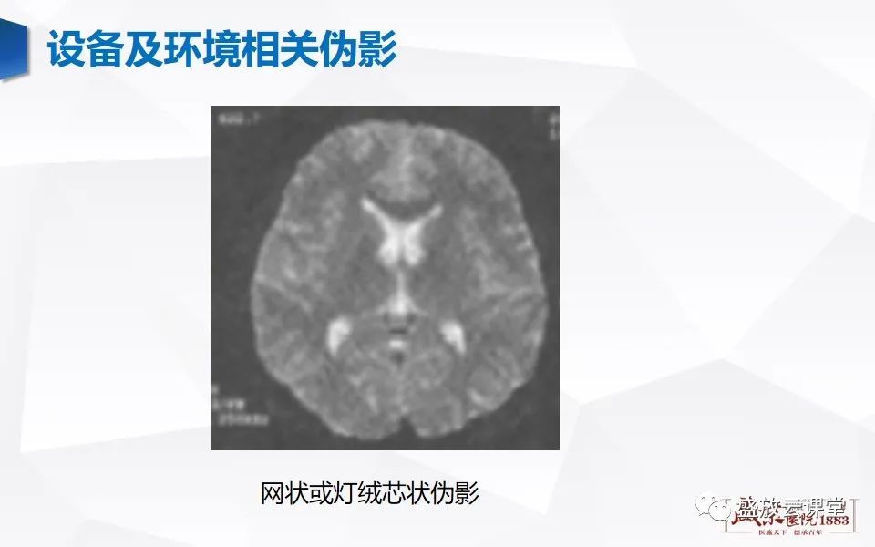影像PPT - 【PPT】头部MR检查中常见的伪影-36