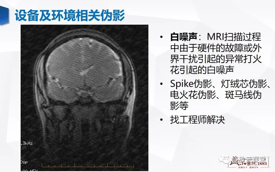 影像PPT - 【PPT】头部MR检查中常见的伪影-35