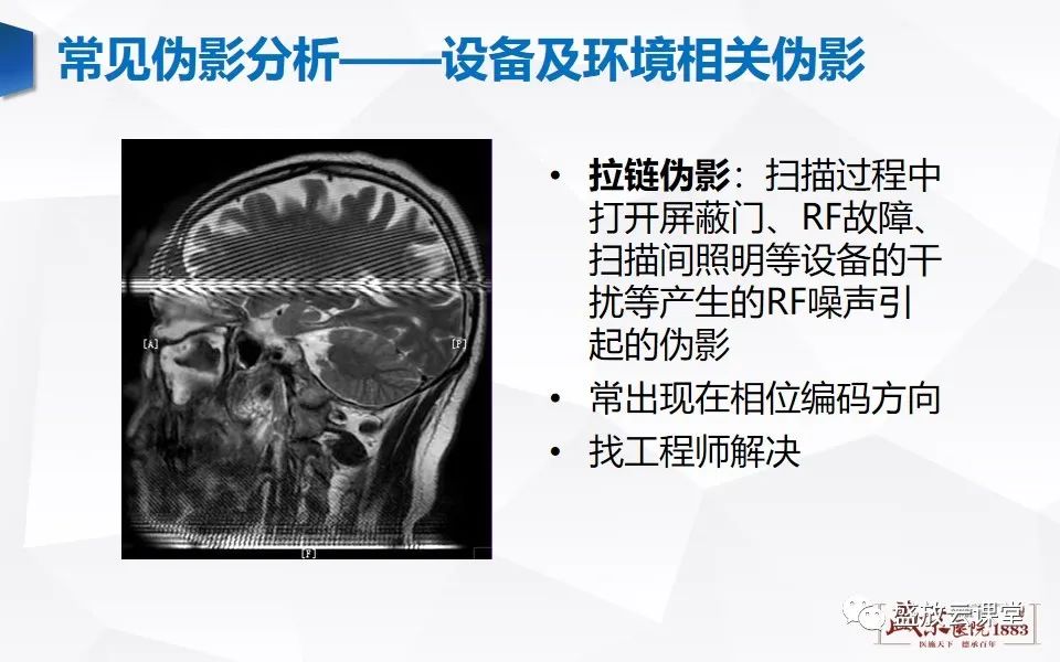影像PPT - 【PPT】头部MR检查中常见的伪影-34