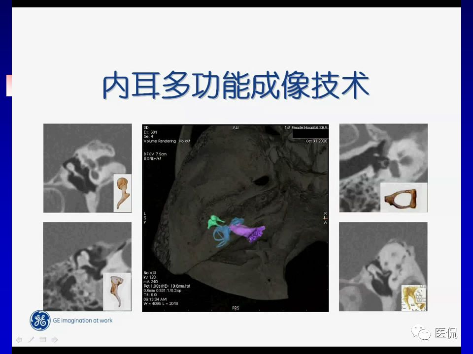 影像PPT - 【PPT】耳部影像诊断-2