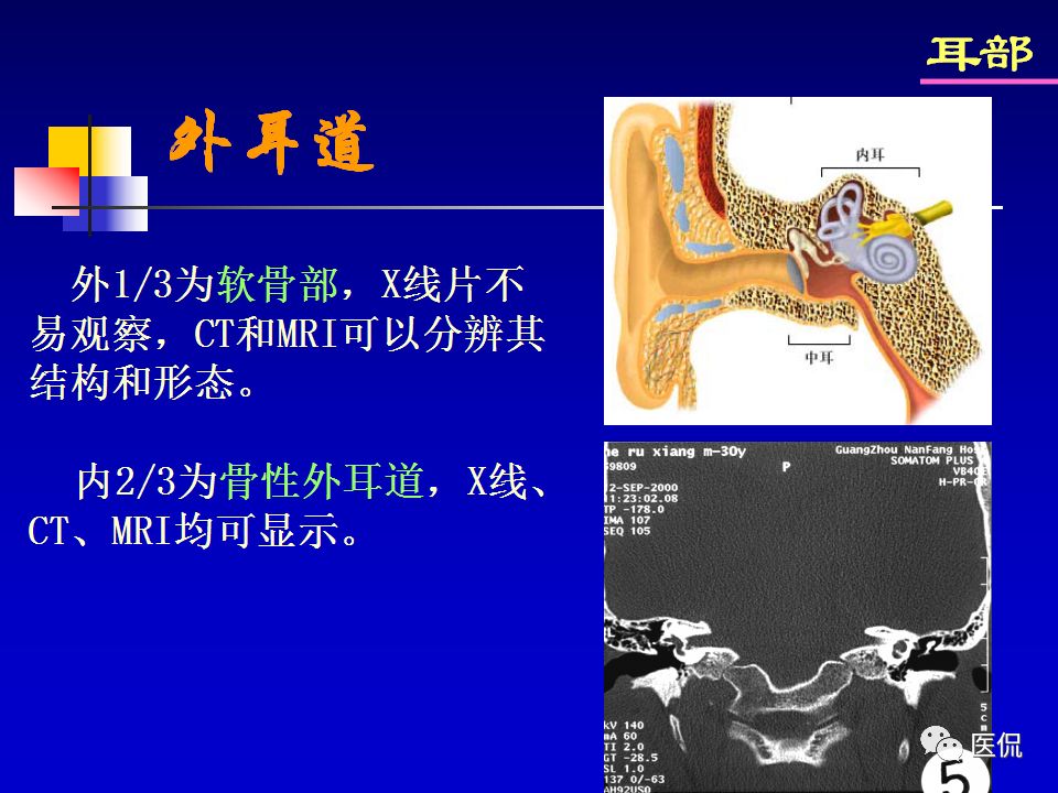 影像PPT - 【PPT】耳部影像诊断-6