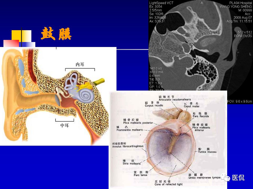 影像PPT - 【PPT】耳部影像诊断-7