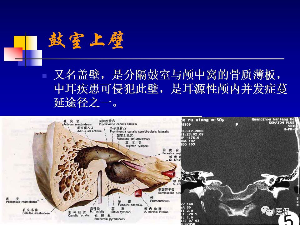 影像PPT - 【PPT】耳部影像诊断-9